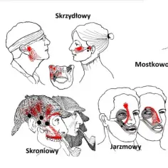 Ból szczęki na tle nerwowym? To przyczyny i sposoby ulgi. Poradnik
